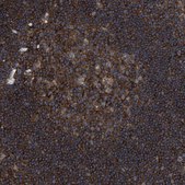 Anti-SPAST antibody produced in rabbit Prestige Antibodies&#174; Powered by Atlas Antibodies, affinity isolated antibody, buffered aqueous glycerol solution