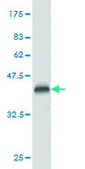 Monoclonal Anti-PLD2 antibody produced in mouse clone 1C5, purified immunoglobulin, buffered aqueous solution