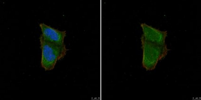 Anti-Calcipressin-1 serum, from rabbit