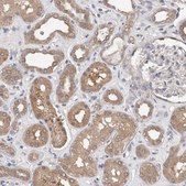 Anti-FHOD3 antibody produced in rabbit Prestige Antibodies&#174; Powered by Atlas Antibodies, affinity isolated antibody, buffered aqueous glycerol solution, Ab2