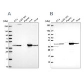 Anti-GOT1 antibody produced in rabbit Prestige Antibodies&#174; Powered by Atlas Antibodies, affinity isolated antibody