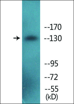 Anti-phospho-IRS-1 (pSer307) antibody produced in rabbit affinity isolated antibody