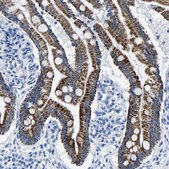 Anti-CPS1 antibody produced in rabbit Prestige Antibodies&#174; Powered by Atlas Antibodies, affinity isolated antibody, buffered aqueous glycerol solution