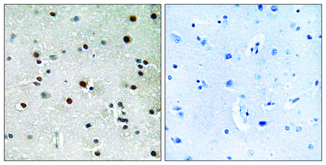 Anti-RFX3, C-Terminal antibody produced in rabbit affinity isolated antibody
