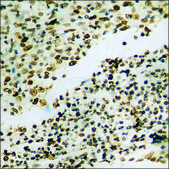Anti-phospho-JAK1 (pTyr1022) antibody produced in rabbit affinity isolated antibody