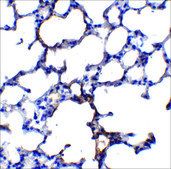 Anti-TRPC6 (ab1) antibody produced in rabbit affinity isolated antibody, buffered aqueous solution