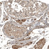 Monoclonal Anti-MYO10 antibody produced in mouse Prestige Antibodies&#174; Powered by Atlas Antibodies, clone CL9032, purified immunoglobulin, buffered aqueous glycerol solution