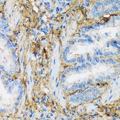 Anti-Collagen VI/COL6A1 Antibody, clone 7J1P4, Rabbit Monoclonal