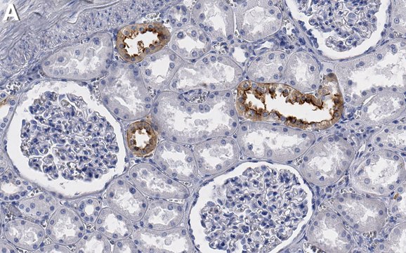 Anti-SLC12A3 Antibody, clone 3I12 ZooMAb&#174; Rabbit Monoclonal recombinant, expressed in HEK 293 cells