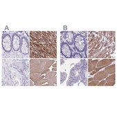 Anti-SRL antibody produced in rabbit Prestige Antibodies&#174; Powered by Atlas Antibodies, affinity isolated antibody, buffered aqueous glycerol solution