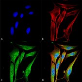Monoclonal Anti-Copper Transporting Atpase 1 - Rpe antibody produced in mouse clone S60-4, purified immunoglobulin