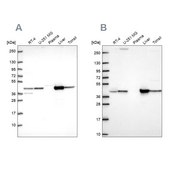 Anti-GOT1 antibody produced in rabbit Prestige Antibodies&#174; Powered by Atlas Antibodies, affinity isolated antibody