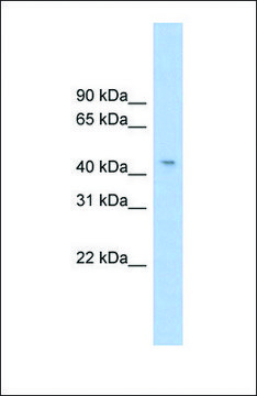 Anti-RG9MTD1 antibody produced in rabbit affinity isolated antibody