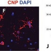 Monoclonal Anti-CNPase antibody produced in mouse clone 11-5B, ascites fluid