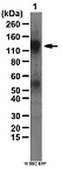 Anti-phospho NR1 (Ser897) Antibody from rabbit, purified by affinity chromatography