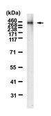 Anti-NF1 Antibody, clone 2N2 ZooMAb&#174; Rabbit Monoclonal recombinant, expressed in HEK 293 cells