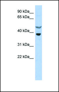 Anti-SOCS7, (N-terminal) antibody produced in rabbit affinity isolated antibody