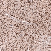 Monoclonal Anti-Msh3 Antibody Produced In Mouse Prestige Antibodies&#174; Powered by Atlas Antibodies, clone CL14059, affinity isolated antibody, buffered aqueous glycerol solution