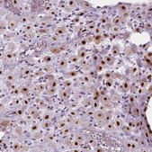 Anti-CDKN1C antibody produced in rabbit Prestige Antibodies® Powered by Atlas Antibodies, affinity isolated antibody, buffered aqueous glycerol solution