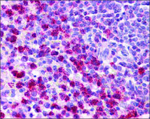 Anti-TGFB1 affinity isolated antibody