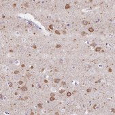 Anti-MAP1A antibody produced in rabbit Prestige Antibodies&#174; Powered by Atlas Antibodies, affinity isolated antibody, buffered aqueous glycerol solution
