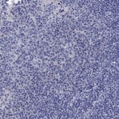 Anti-CETN1 antibody produced in rabbit Prestige Antibodies&#174; Powered by Atlas Antibodies, affinity isolated antibody, buffered aqueous glycerol solution