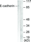 Anti-E-cadherin antibody produced in rabbit affinity isolated antibody