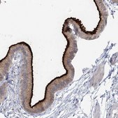 Anti-SLC9A3 antibody produced in rabbit Prestige Antibodies® Powered by Atlas Antibodies, affinity isolated antibody, buffered aqueous glycerol solution