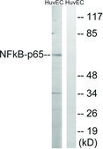 Anti-NF-&#954;B p65 antibody produced in rabbit affinity isolated antibody