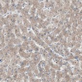 Anti-KHK antibody produced in rabbit Prestige Antibodies&#174; Powered by Atlas Antibodies, affinity isolated antibody, buffered aqueous glycerol solution