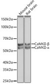 Anti-CaMKII Antibody, clone 7L9F0, Rabbit Monoclonal