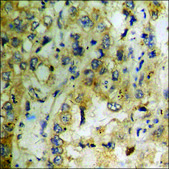 Anti-phospho-Telomerase (pSer824) antibody produced in rabbit affinity isolated antibody
