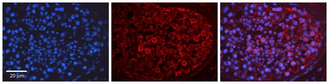Anti-MAPK1 (C-terminal) antibody produced in rabbit affinity isolated antibody