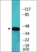 Anti-phospho-p53 (pSer366) antibody produced in rabbit affinity isolated antibody