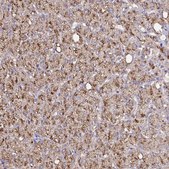 Anti-CAT antibody produced in rabbit Prestige Antibodies® Powered by Atlas Antibodies, affinity isolated antibody, buffered aqueous glycerol solution