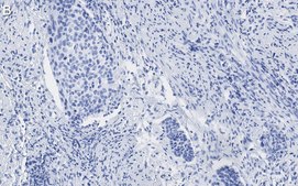 Anti-p16-INK4a Antibody, clone 5F22 Antibody, ZooMAb&#174; Rabbit Monoclonal recombinant, expressed in HEK 293 cells