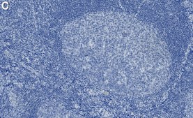 Anti-LAT Antibody, clone 2B4 ZooMAb&#174; Rabbit Monoclonal recombinant, expressed in HEK 293 cells