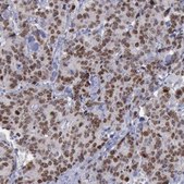 Anti-SATB2 antibody produced in rabbit Prestige Antibodies&#174; Powered by Atlas Antibodies, affinity isolated antibody, buffered aqueous glycerol solution