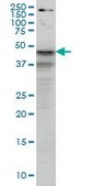 Monoclonal Anti-SHBG antibody produced in mouse clone 5E6, purified immunoglobulin, buffered aqueous solution