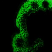 Monoclonal Anti-Cytokeratin, pan antibody produced in mouse clone C-11, ascites fluid