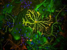 Anti-Glial Fibrillary Acidic Protein Antibody Chemicon&#174;, from chicken