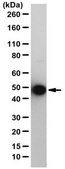Anti-Neuron Specific Enolase Antibody from rabbit