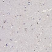 Anti-LYN antibody produced in rabbit Prestige Antibodies&#174; Powered by Atlas Antibodies, affinity isolated antibody, buffered aqueous glycerol solution
