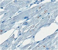 Anti-GD1a Ganglioside Antibody, clone GD1a-1 (Azide Free) clone GD1a-1, from mouse