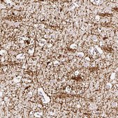 Anti-CNP antibody produced in rabbit Prestige Antibodies&#174; Powered by Atlas Antibodies, affinity isolated antibody, buffered aqueous glycerol solution, Ab3