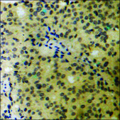 Anti-phospho-BLNK (pTyr96) antibody produced in rabbit affinity isolated antibody