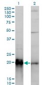 Monoclonal Anti-KRAS antibody produced in mouse clone 3B10-2F2, purified immunoglobulin, buffered aqueous solution