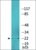Anti-phospho-p27 Kip1 (pSer10) antibody produced in rabbit affinity isolated antibody
