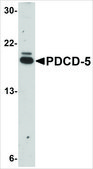 Anti-PDCD5 antibody produced in rabbit affinity isolated antibody, buffered aqueous solution