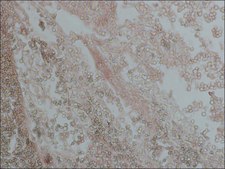 Monoclonal Anti-Proliferating Cell Nuclear Antigen antibody produced in mouse clone PC 10, ascites fluid